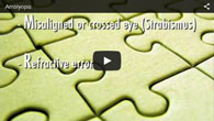 Amblyopia (Lazy Eye) treated by ECVA Eye Care